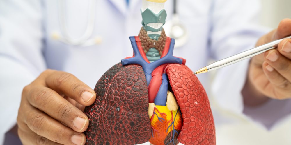 Pneumonia, lung cancer, Asian doctor holding human anatomy model for study diagnosis and treatment in hospital.